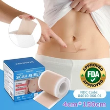Silicone Scar Sheets (1.6"X 60" Roll), Silicone Scar Tape for Scar Removal US