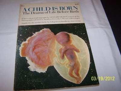 A Child is Born the Drama of Life Before Birth in Unprecedented Photographs