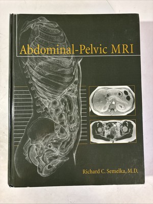 Abdominal-Pelvic MRI by Richard C. Semelka, M.D.  *