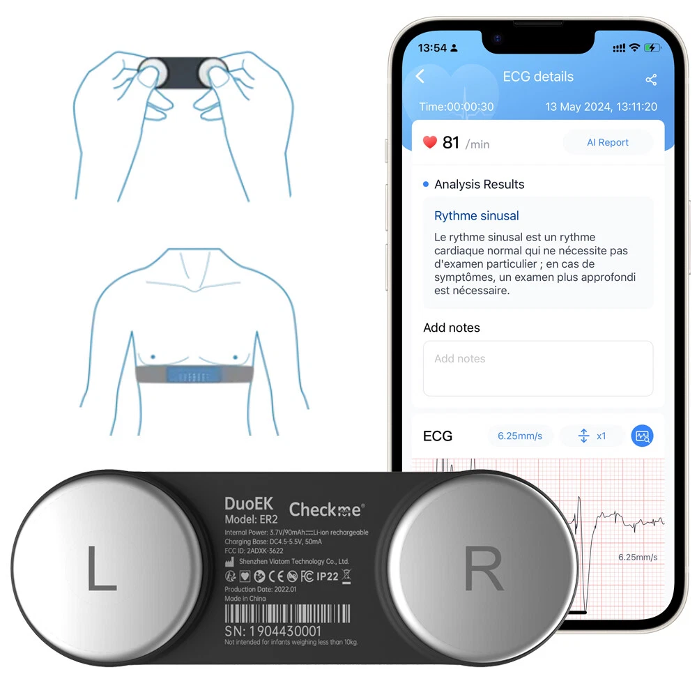 Portable ECG EKG Heart Monitor 30s-15mins Recording with AI-ECG Analysis - Picture 1 of 13