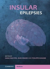Insular Epilepsies by Dang Nguyen (English) Book & Merchandise Book