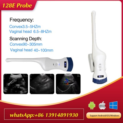 Kabelloser Farbdoppler Ultraschallscanner 128E Konvex/Transvagina Hohlraum - Bild 1 von 6