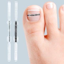 Ingrown Toe Foot Nail Correction Sticker Pedicure Tool Toenail Corrector