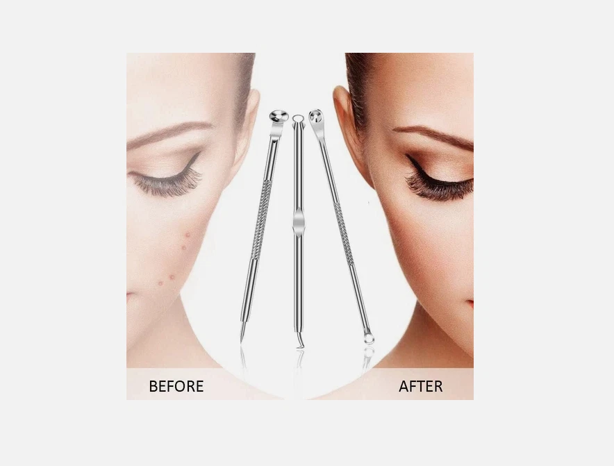 Pimple Popper Tool Kit, Blackhead Remover Comedone Extractor for Acne - Image 2 of 4