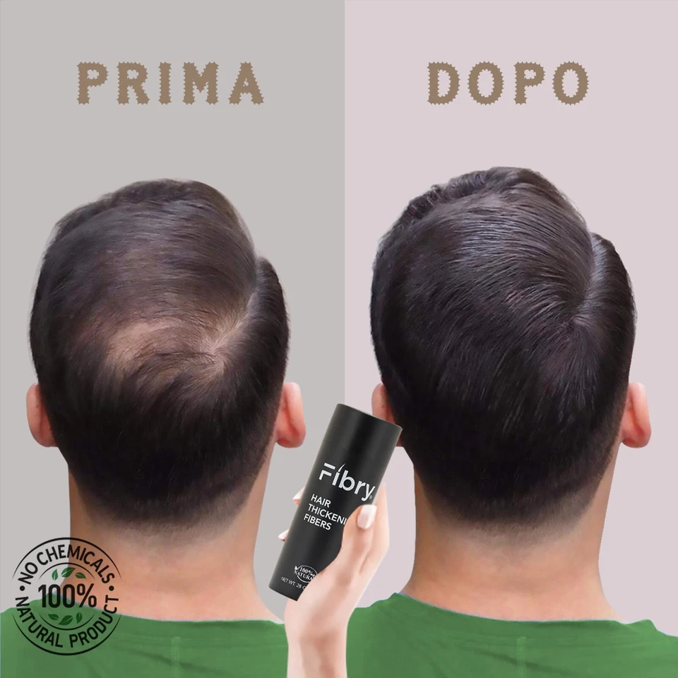 FIBRY Microfibre Anti Diradamento, Fibre Capillari Anti Calvizie, 28 Grammi - Immagine 3 di 4