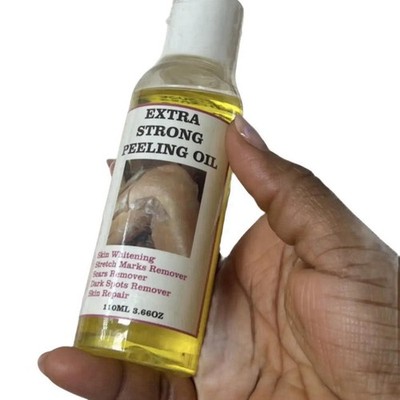 ORIGINAL Extra Starkes Peelingöl für Dehnungsstreifen Hautreinigendes Öl 110ml