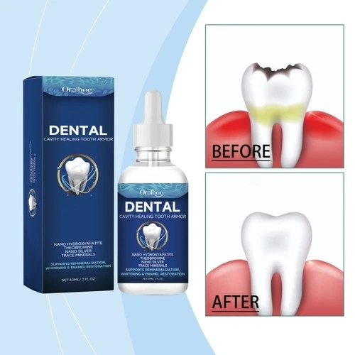Dental Cavity Healing Tooth Armor Liquid,60ml Hydroxyapatite Tooth Repair Serum