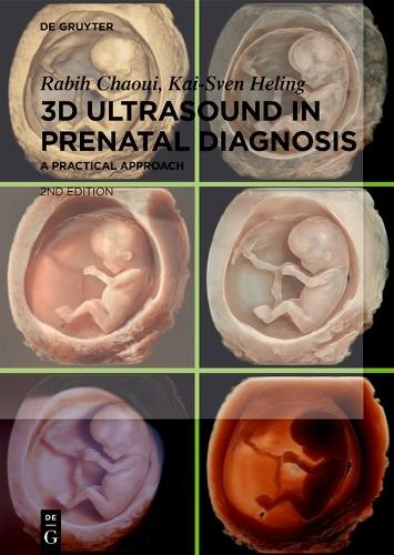 Rabih Chaoui Kai-Sven Heli 3D Ultrasound in Prenatal Diagnos (Copertina rigida)