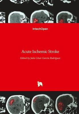 Acute Ischemic Stroke Julio Cesar Garcia Rodriguez