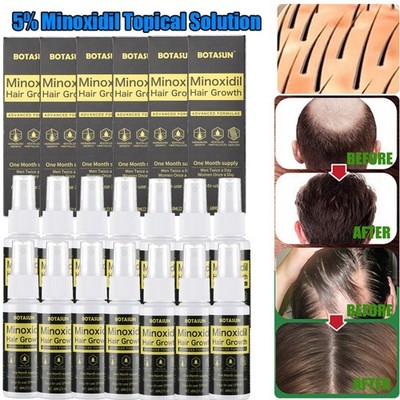 Fast Hair Growth Spray Anti-BaldnessThickening Grow Moisturize Hair Repair Split