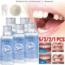Tooth Repair Beads Granules Temporary Tooth Glue Reusable Moldable False Teeth