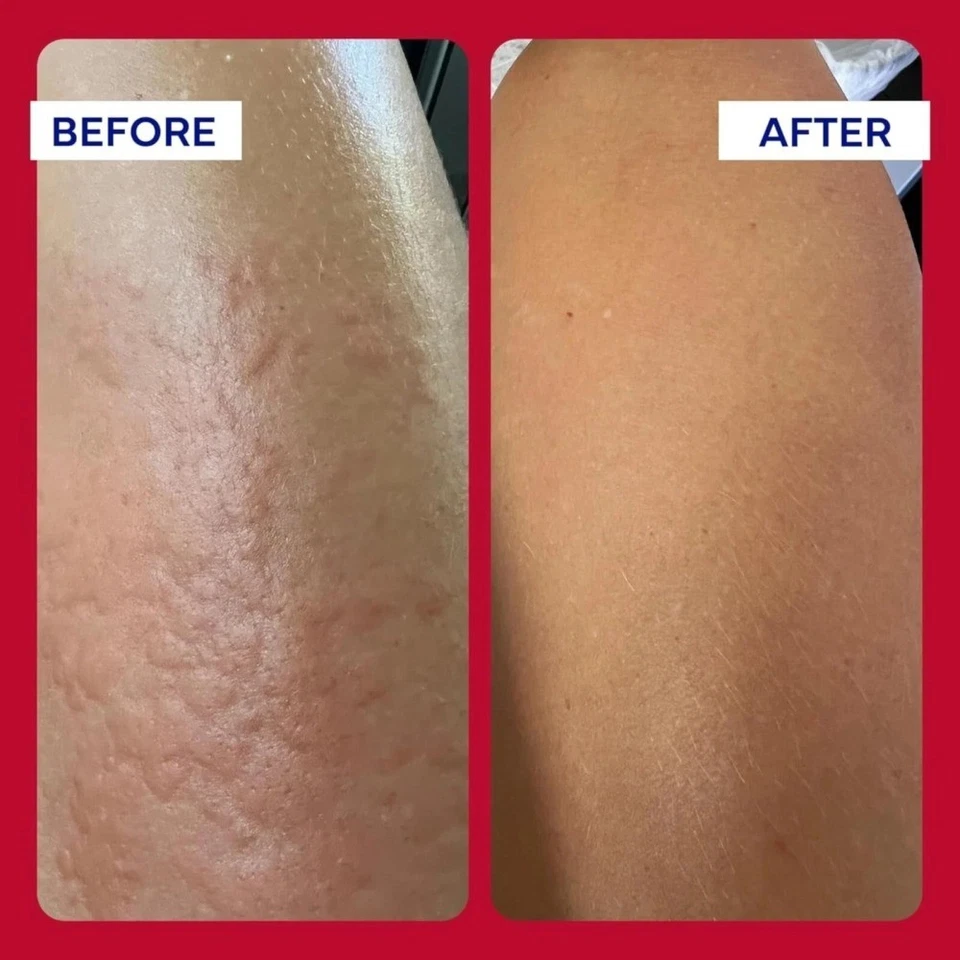 3PCS EMUAID Maximum Strength First Aid Ointment 2oz 59ml for Itchy Skin - image 4 of 4