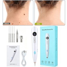 Beauty Mole Removal Pen 9-speed Dark Spot Remover Skin Wart Tag Remover