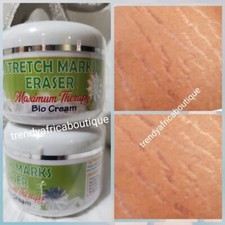 Evob Stretch Marks Eraser maximum therapy bio cream 100g x 1