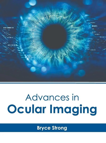 Bryce Strong | Advances In Ocular Imaging | Buch | Englisch (2023)-image