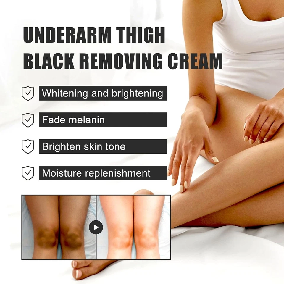 Whitening Cream Quickly Private Parts Dark Skin Underarm Brightening  2 Pack - Image 4 of 4