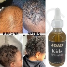 kids hair growth oil