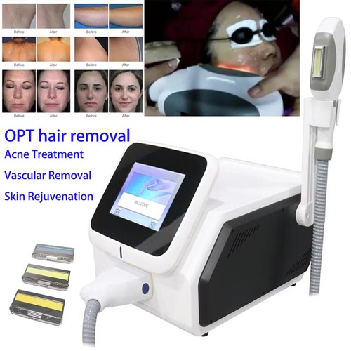 IPL OPT Laser Machine Hair Removal Vascular Removal Skin Rejuvenation ...