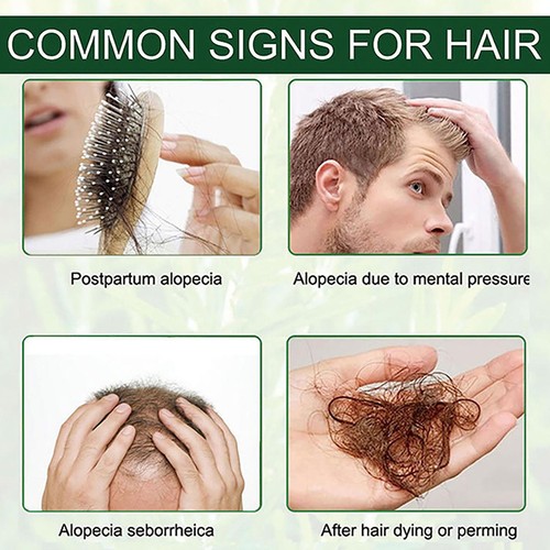 Haarwuchsöl mit Rosmarin - natürliche organische Kräuterbehandlung - für alle Haare - Bild 9 von 12