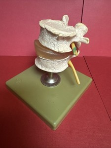 VINTAGE SOMSO W Germany Anatomical Vertebra Spine Disc Nerve Medical Model (SH45