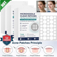 Curalona Microneedle Patches 144-432x, Skin Tag Wart Acne Remover Patches 20