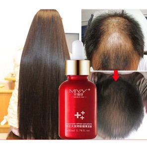 Hair Growth Essence Advanced Thinning Hair Hair Loss Supplement