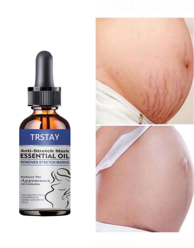 estrías hidratar, suavizar, reafirmar, reparar Foto 3 de 4