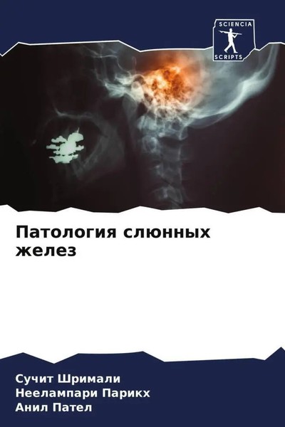 Suchit Shrimali (U. A.) | Patologiq SlüNnyh Zhelez | Taschenbuch | Russisch-image