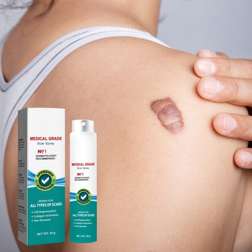 Scar Removal Spray Desalinates Scar Smoothing Skin Care Spray - Picture 5 of 12