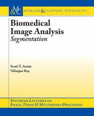 Biomedical Image Analysis: Segmentation (Synthesis Lectures on Image, Video, & M