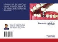 Titanium & Its Role In Dentistry Gibi Babu Philip