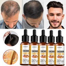 5/3Pcs Batana Oil Serum for Hair Growth, Batana Oil Essence, Repair Damaged Hair