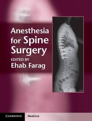 Anesthesia for Spine Surgery by Ehab Farag - 9781107005310