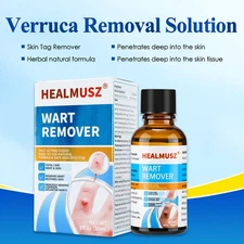 HEALMUSZ Wart Remover Liquid Plantar Wart Removers for Feet Body Herbal Forula