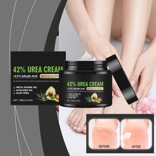 42 Urea Cream for Dry Cracked Hands and Feet 100g Deep Hydration Skin Repairing