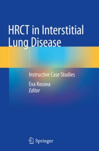 Thumbnail - Hrct In Interstitial Lung Disease Instructive Case Studies 6145