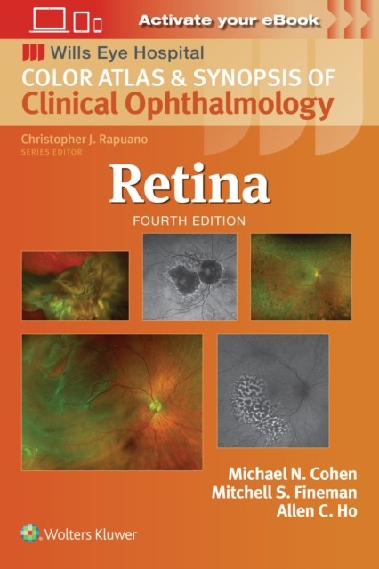 Retina by Mitchell S., MD Fineman (Paperback Book)