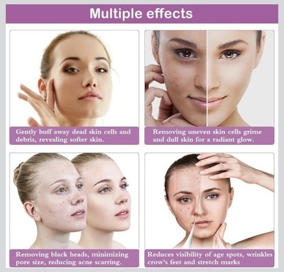 Yofuly Diamond Microdermabrasion Machine, 65-68cmHg Suction Power P... Fast Ship