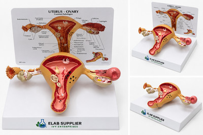 Human Female Uterus Ovary Anatomy Model on Stand Medical Teaching Lab Fiber