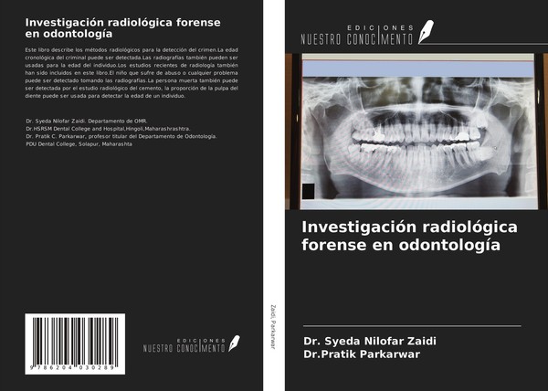 InvestigacióN RadiolóGica Forense En OdontologíA Pratik Parkarwar-image