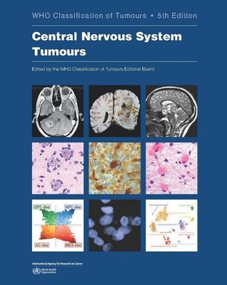 Central Nervous System Tumours Paperback USA STOCK USPS