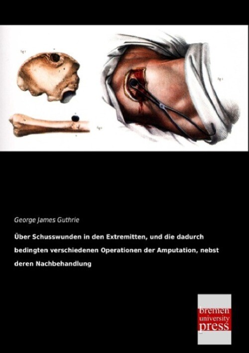 Thumbnail - George James Guthrie | Über Schusswunden In Den Extremitten, Und Die