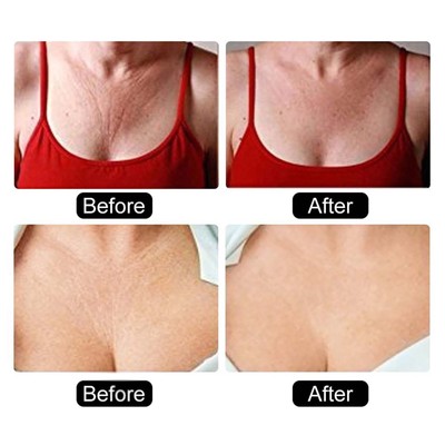 Silikon-Anti-Falten-Brust-Pad Wiederverwendbare Anti-Aging-Brust-Patch-Aufkl FOY