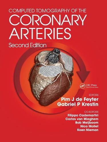 Computed Tomography of the Coronary Arteries - 9781841846576