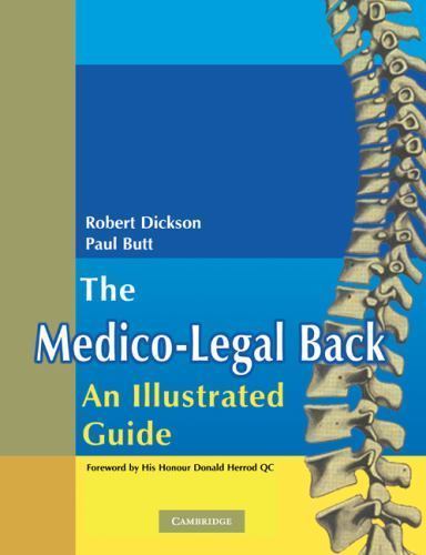 The Medico-Legal Back: An Illustrated Guide Dickson Butt Paperback 9780521283205