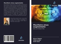 Divya Thakur (U. A.) | Maxillaire Sinus Augmentatie | Taschenbuch (2021)