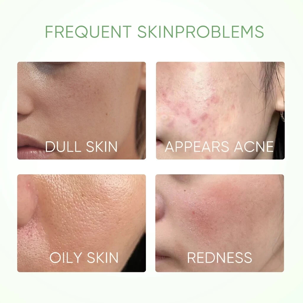 SKINTIFIC Mugwort Acne Clay Mask Stick 40g Reduces Redness, Inflammation