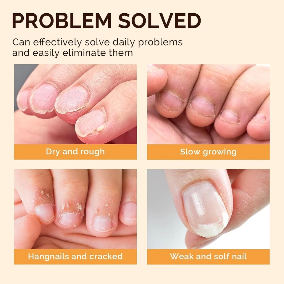 Juego de 15 bolígrafos de aceite para cutículas, aceite para cutículas hidratante para uñas enriquecido con vitamina ES Foto 2 de 4