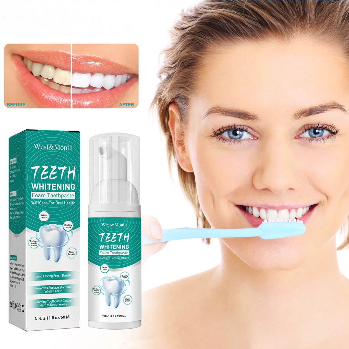 How To Manage Tooth Sensitivity During A Tooth Whitening