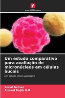 Um Estudo Comparativo Para AvaliaçãO De MicronúCleos Em CéLulas Bucais Sonal Gro